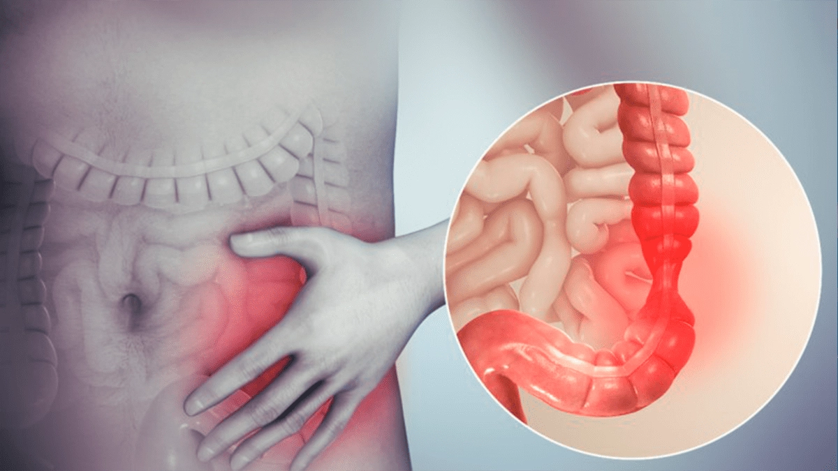 trastornos-gastrointestinales
